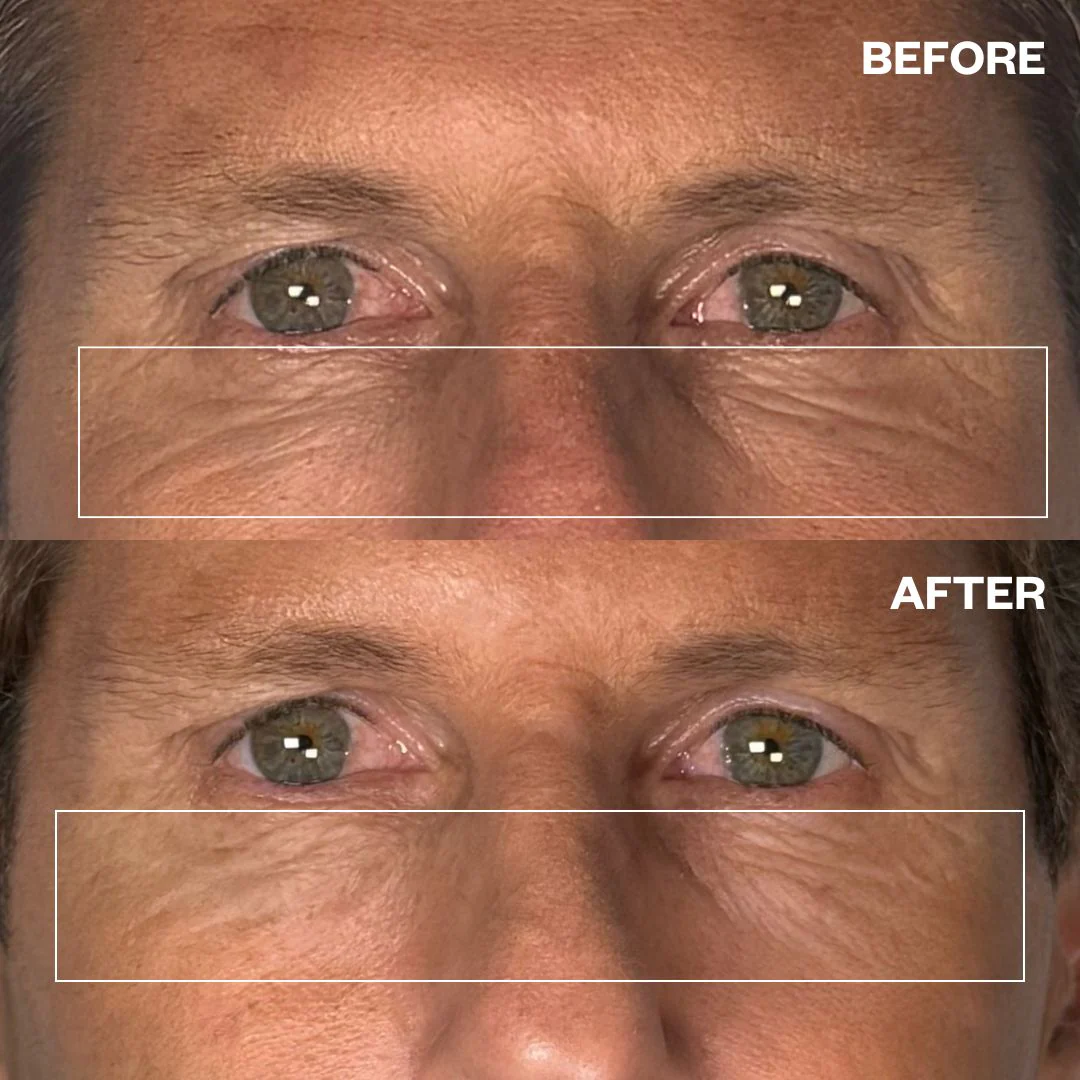 Men's Pro Eye Wrinkle Patches - One Pair - Image 5
