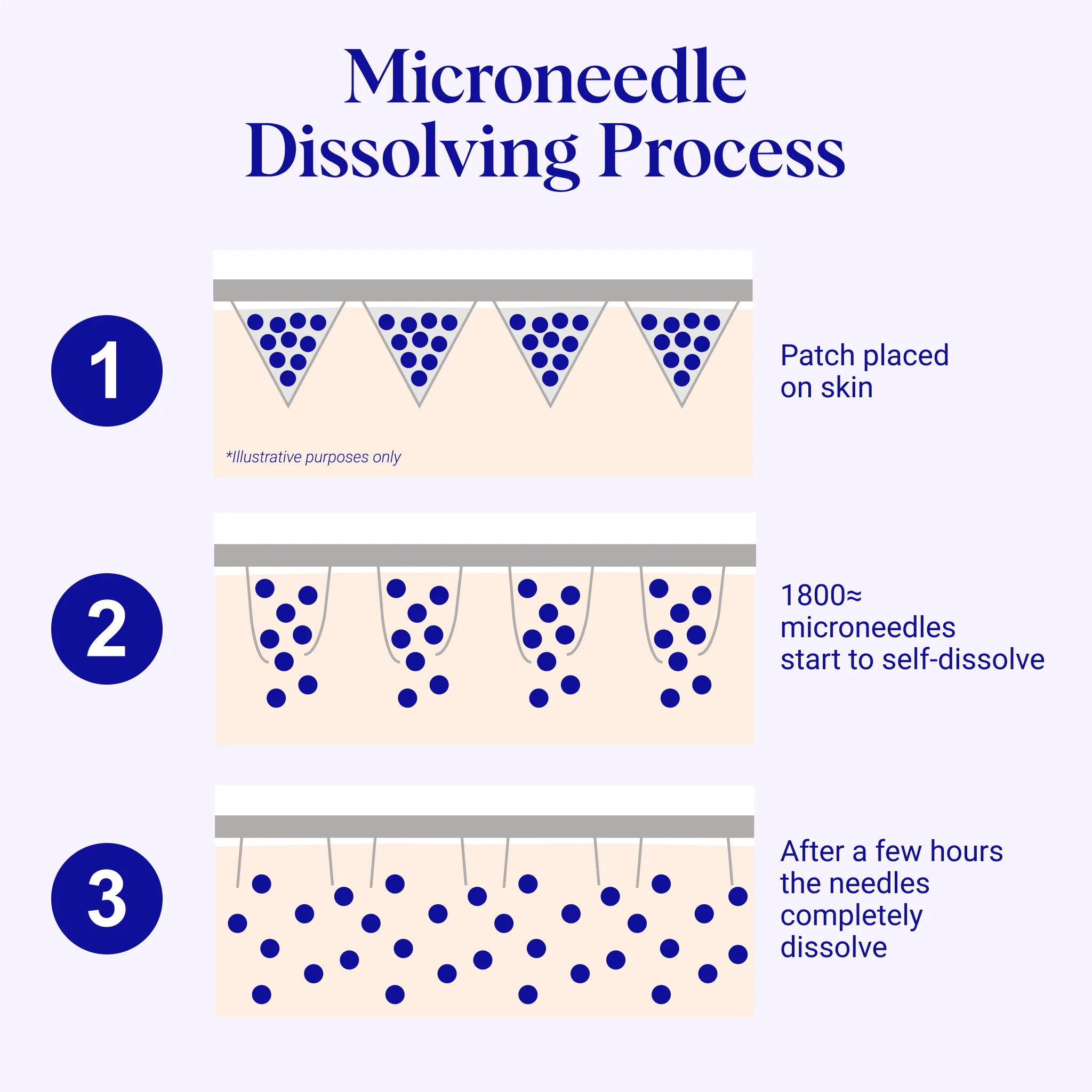 Self-Dissolving Microneedle Patches - Image 4