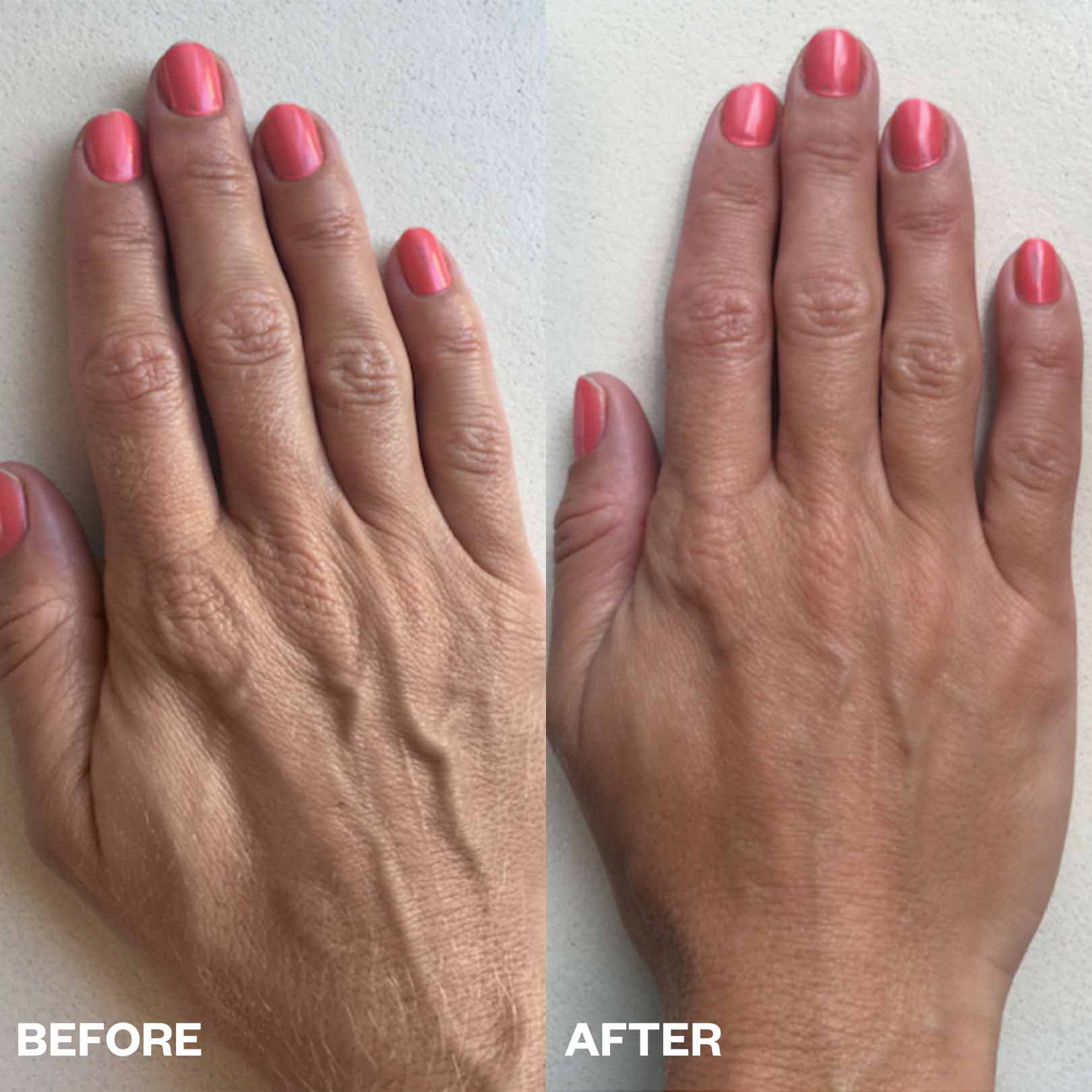 Hand Wrinkle Patches - Image 4